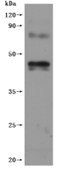 SDS-PAGE (CNR1-718H).jpg
